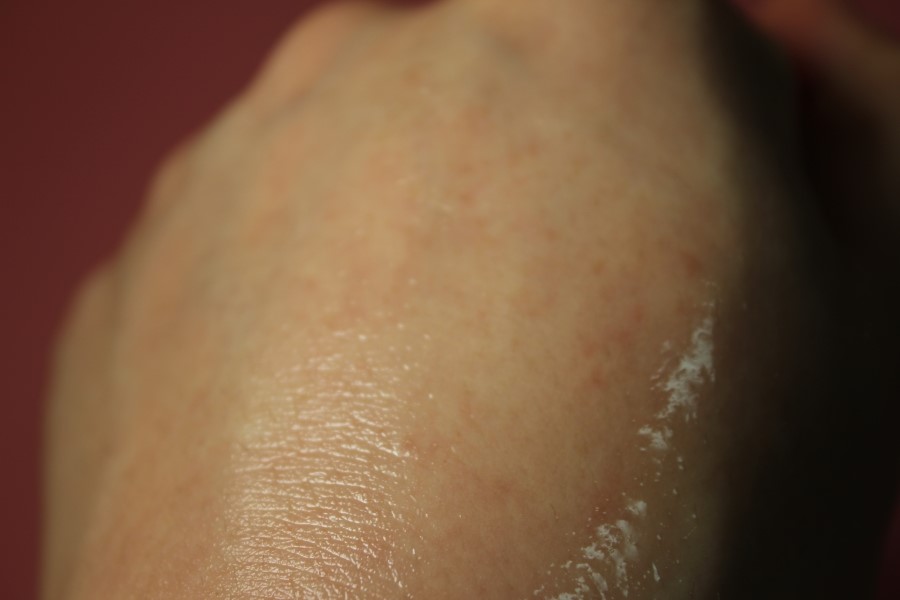 좁쌀여드름 클렌징폼 환상의 케미를 자랑하네요 관련 이미지 8