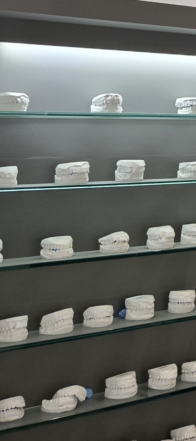 어금니 임플란트 뼈이식 이럴때 해당됩니다 관련 이미지 28