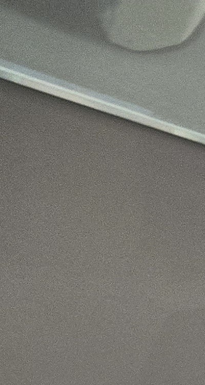 사랑니 주변 잇몸 통증 지금부터가 중요하니까 관련 이미지 15