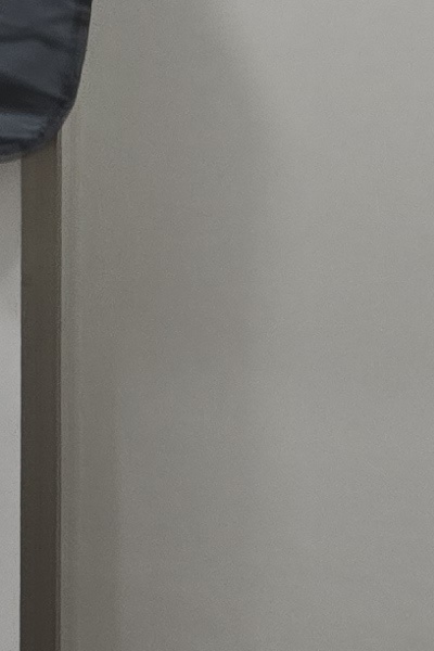 부정교합 교정 안하면 생기는 문제는 뭔가요 관련 이미지 46