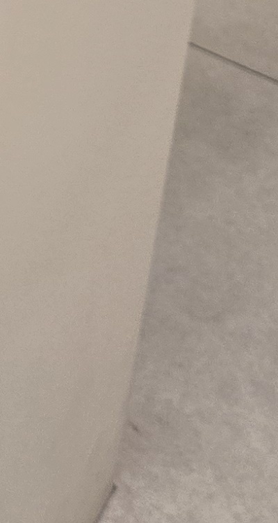 신경치료 아픈가요 망설이시는 분들이라면 관련 이미지 48