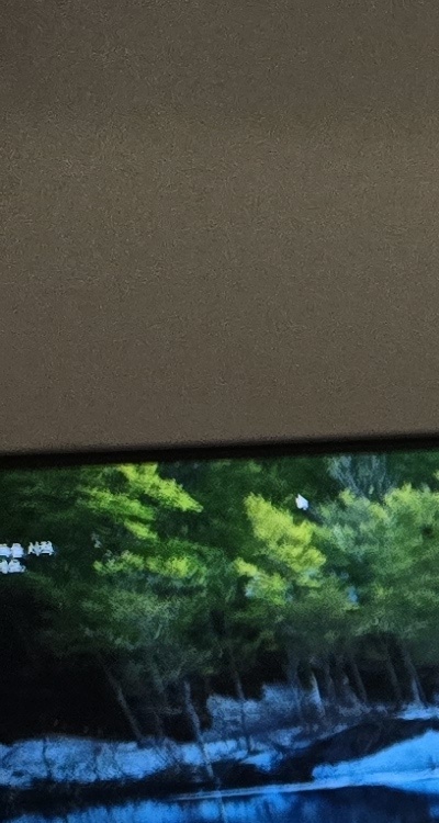 신경치료 아픈가요 망설이시는 분들이라면 관련 이미지 11