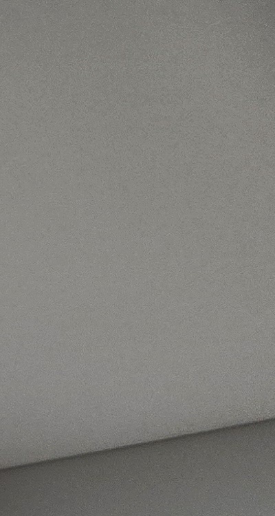 치아 발치 후 임플란트 언제부터 준비할까 관련 이미지 22