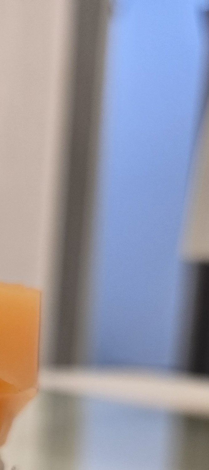 송곳니 덧니 발치 이럴때 해당되네요 관련 이미지 16