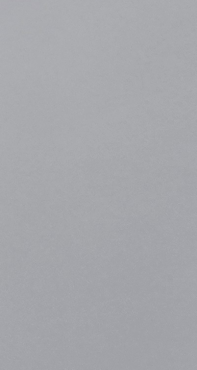 앞니 부분 교정 간단하니까 좋은건가요 관련 이미지 41