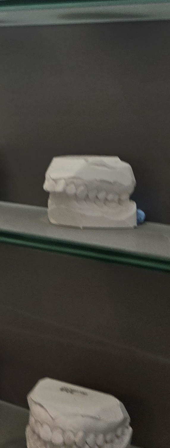 치과 치아미백 효과 어떤식으로 나타날까 관련 이미지 41