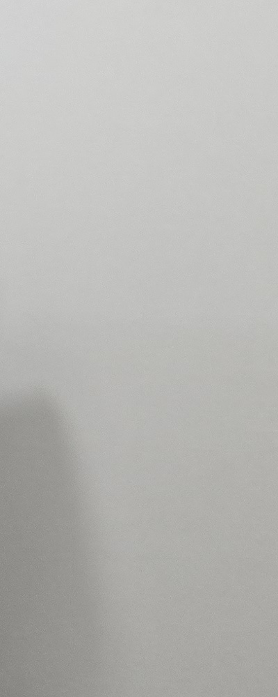 인레이 치료 후 신경치료 이유가 궁금하다면 관련 이미지 30