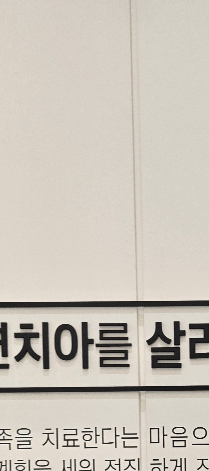 어금니 임플란트 과정 기간 어느정도 예상되나요 관련 이미지 14