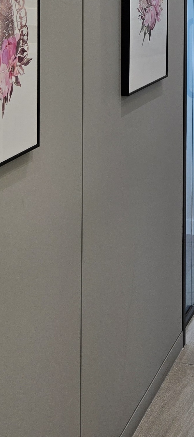 앞니 틀어짐 교정 방법 이럴때는 좀더 간단해요 관련 이미지 29