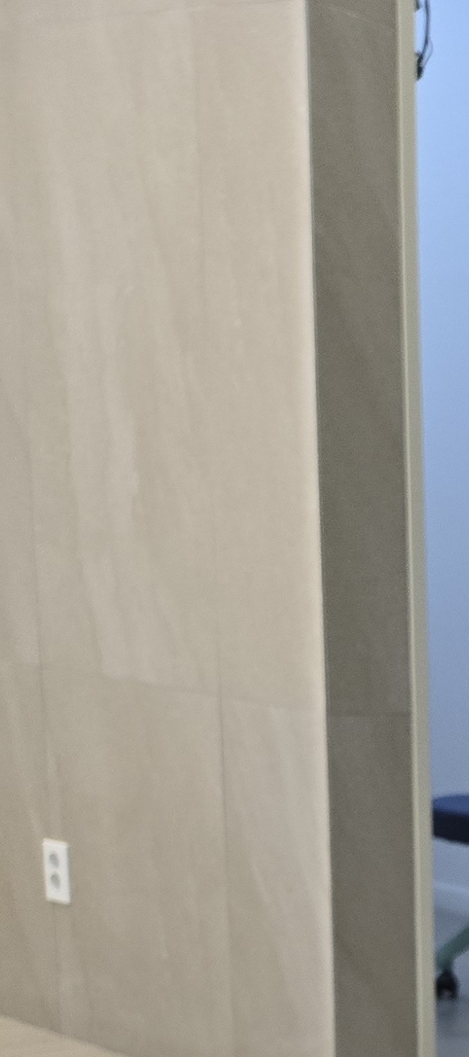 앞니 틀어짐 교정 방법 이럴때는 좀더 간단해요 관련 이미지 9