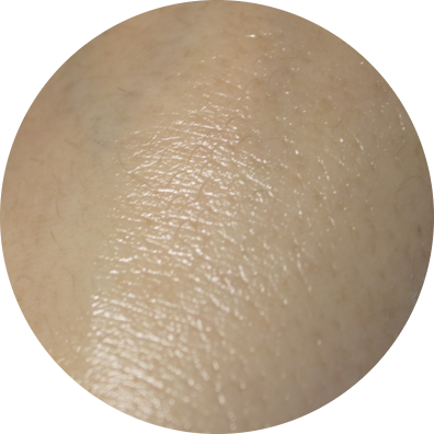 튼살오일 몽디에스 마더투비 6달동안의 사용기 관련 이미지 12