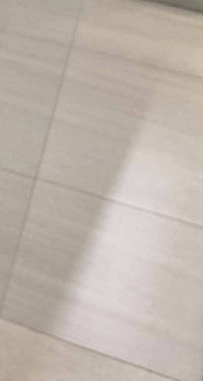 신경치료 아픈가요 망설이시는 분들이라면 관련 이미지 40