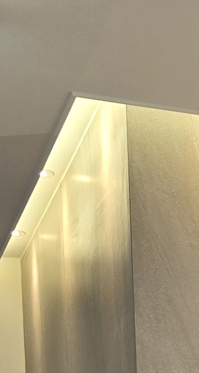 앞니 부분 교정 간단하니까 좋은건가요 관련 이미지 16