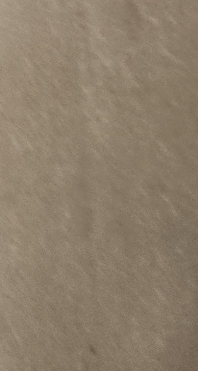 앞니 올세라믹 이건 알고 시작하세요 관련 이미지 49