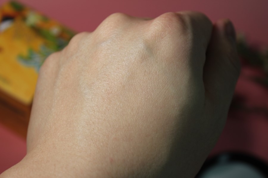 겨울철 피부 가려움 르퀼라야 퓨어텐 모이스처라이저로 해결하자 관련 이미지 13