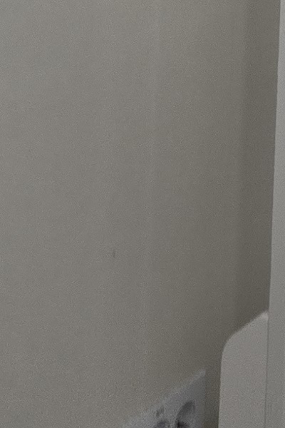 부정교합 교정 안하면 생기는 문제는 뭔가요 관련 이미지 52