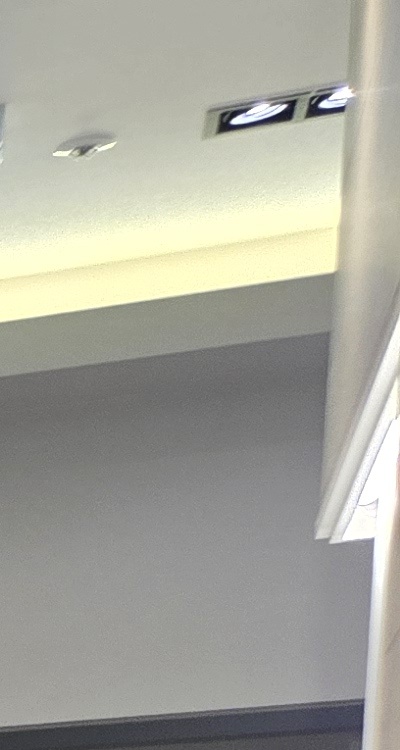 임플란트의 장점 할까 말까 고민이신 분들을 위한 정리 관련 이미지 19