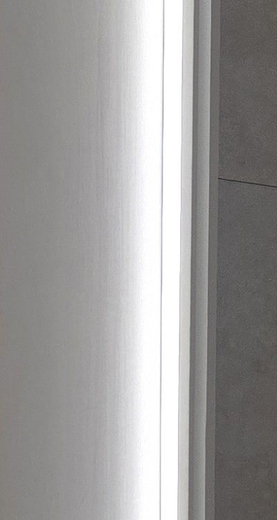 앞니 틀어짐 교정 조화롭게 마무리하려면 관련 이미지 24