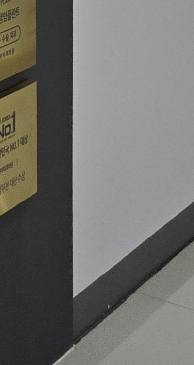 치아 발치 후 임플란트 언제부터 준비할까 관련 이미지 50