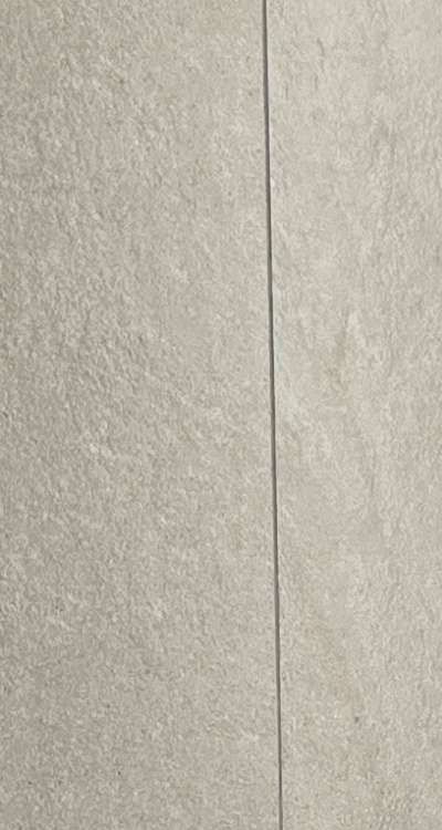 임플란트의 장점 할까 말까 고민이신 분들을 위한 정리 관련 이미지 23