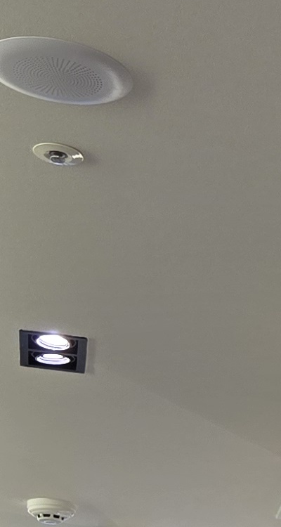 반대교합 치아교정 해결 가능할까 관련 이미지 20