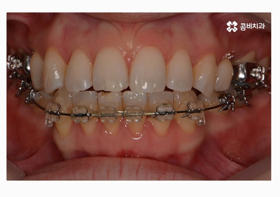 콤비교정 합리적으로 판단하려면 관련 이미지 10