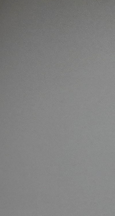 치아 발치 후 임플란트 언제부터 준비할까 관련 이미지 32