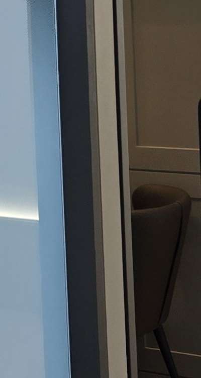 아말감 교체 레진 인레이 어떻게 대처하면 될까 관련 이미지 37