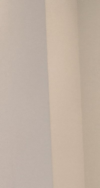 앞니 올세라믹 이건 알고 시작하세요 관련 이미지 11