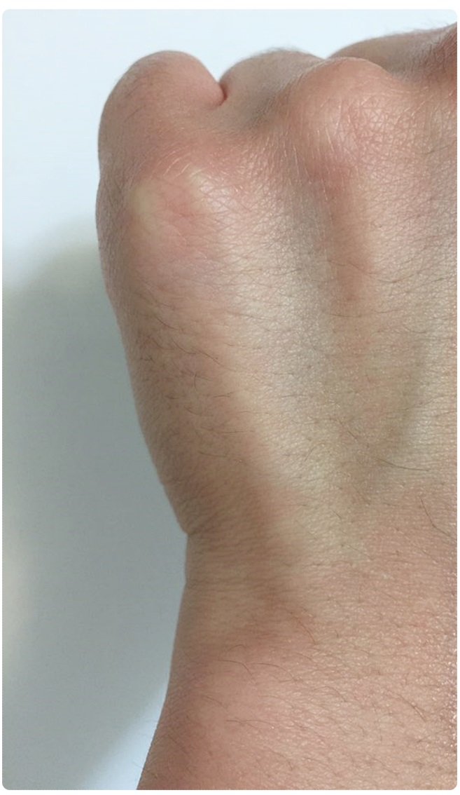 커버력 좋은 파운데이션 추천 피부 고민 해결! 관련 이미지 5