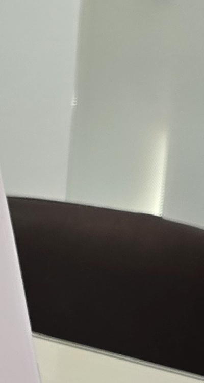 신경치료 아픈가요 망설이시는 분들이라면 관련 이미지 27