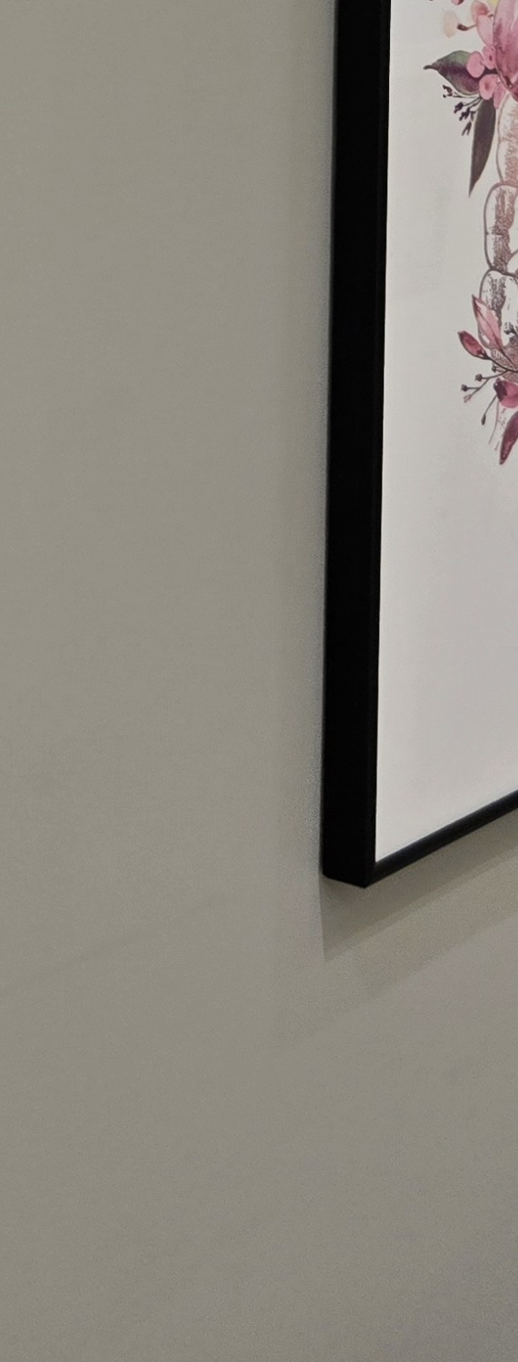 비발치 돌출입 교정 어떨때 적절할까 관련 이미지 32