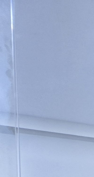 사랑니 발치 후 충치 치료 둘다 준비하려면 관련 이미지 11