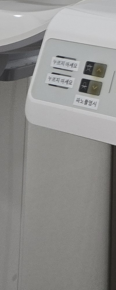 인레이 치료 후 신경치료 이유가 궁금하다면 관련 이미지 36