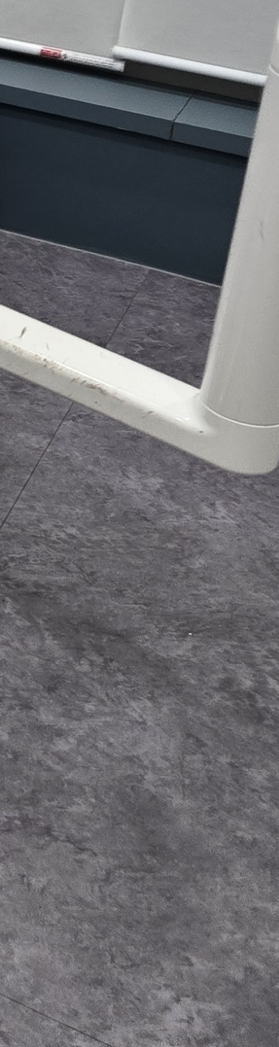 치과 치아미백 효과 어떤식으로 나타날까 관련 이미지 27