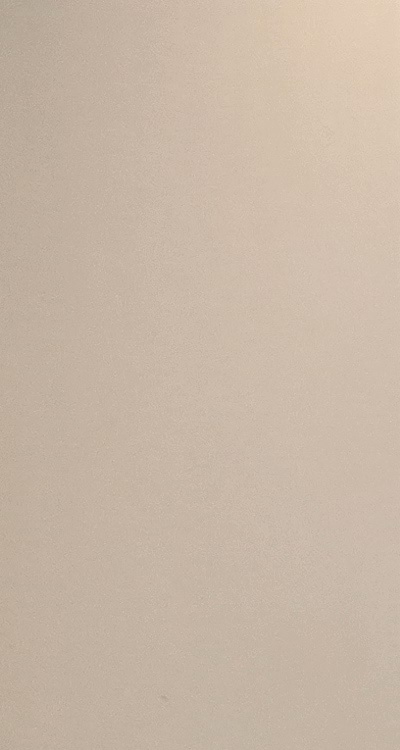 앞니 올세라믹 이건 알고 시작하세요 관련 이미지 12