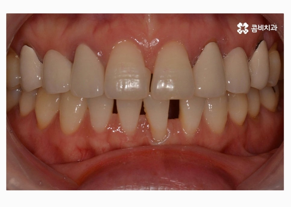 30대임플란트 향후 미래를 바라본다면 관련 이미지 1