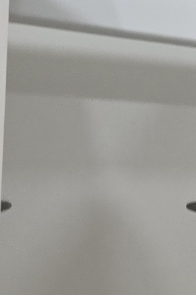 부정교합 교정 안하면 생기는 문제는 뭔가요 관련 이미지 31