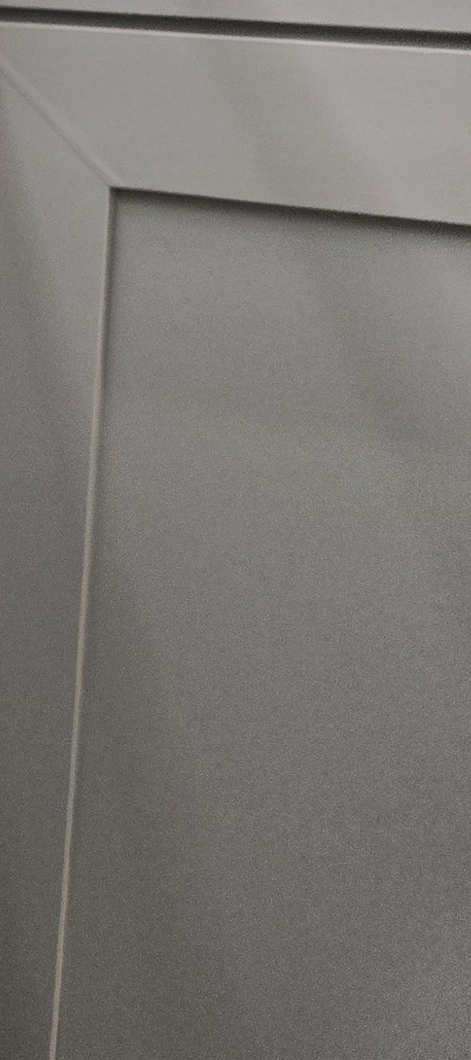 오래된 보철물 아말감 교체 어떠한 케이스일까 관련 이미지 21