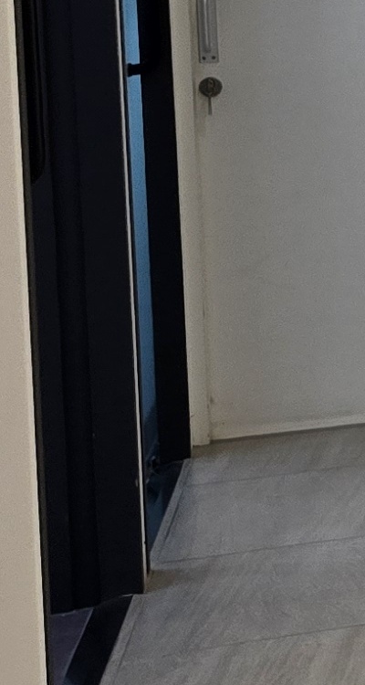 앞니 부분 교정 간단하니까 좋은건가요 관련 이미지 34