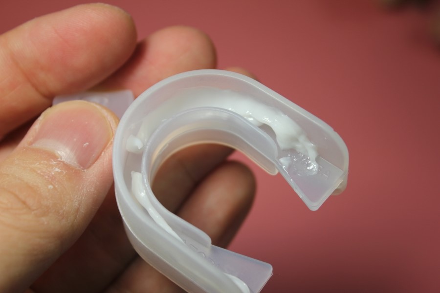 치아미백가격 집에서 치약 하나로 본전 뽑아볼까 관련 이미지 13