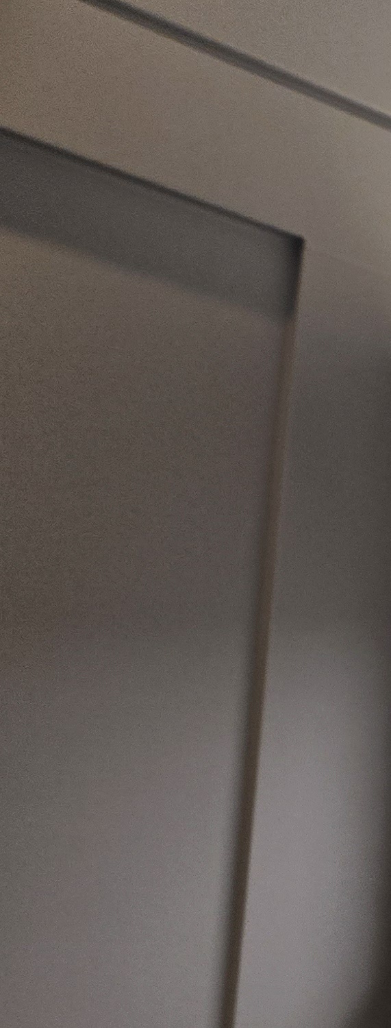 치과 치아미백 효과 어떤식으로 나타날까 관련 이미지 30