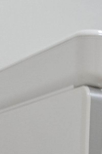 부정교합 교정 안하면 생기는 문제는 뭔가요 관련 이미지 20