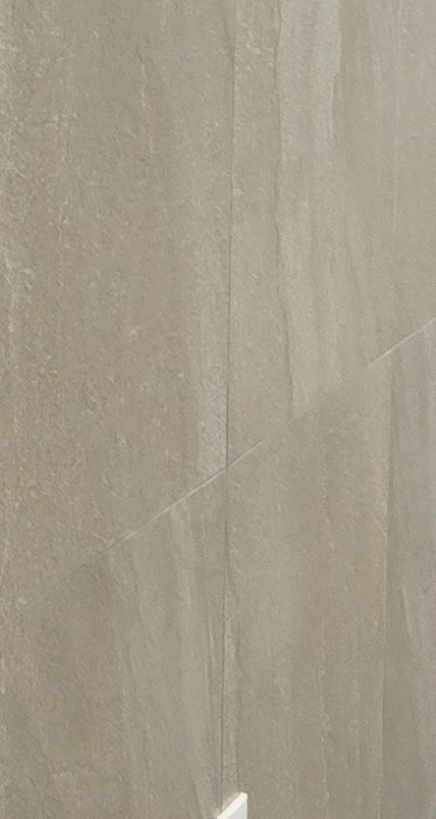 임플란트의 장점 할까 말까 고민이신 분들을 위한 정리 관련 이미지 36