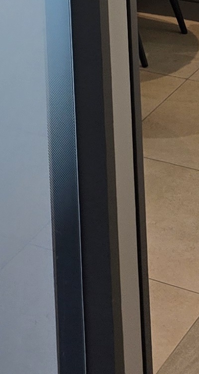 아말감 교체 레진 인레이 어떻게 대처하면 될까 관련 이미지 47