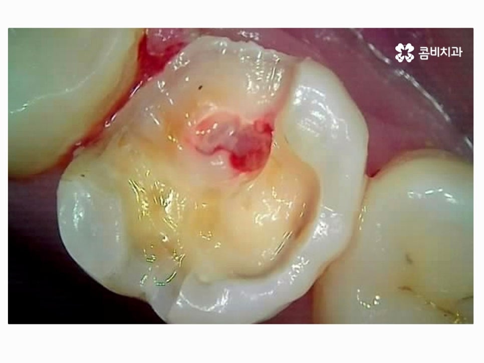 명동치과 누구나 놓치기 쉬운 문제점은! 관련 이미지 8