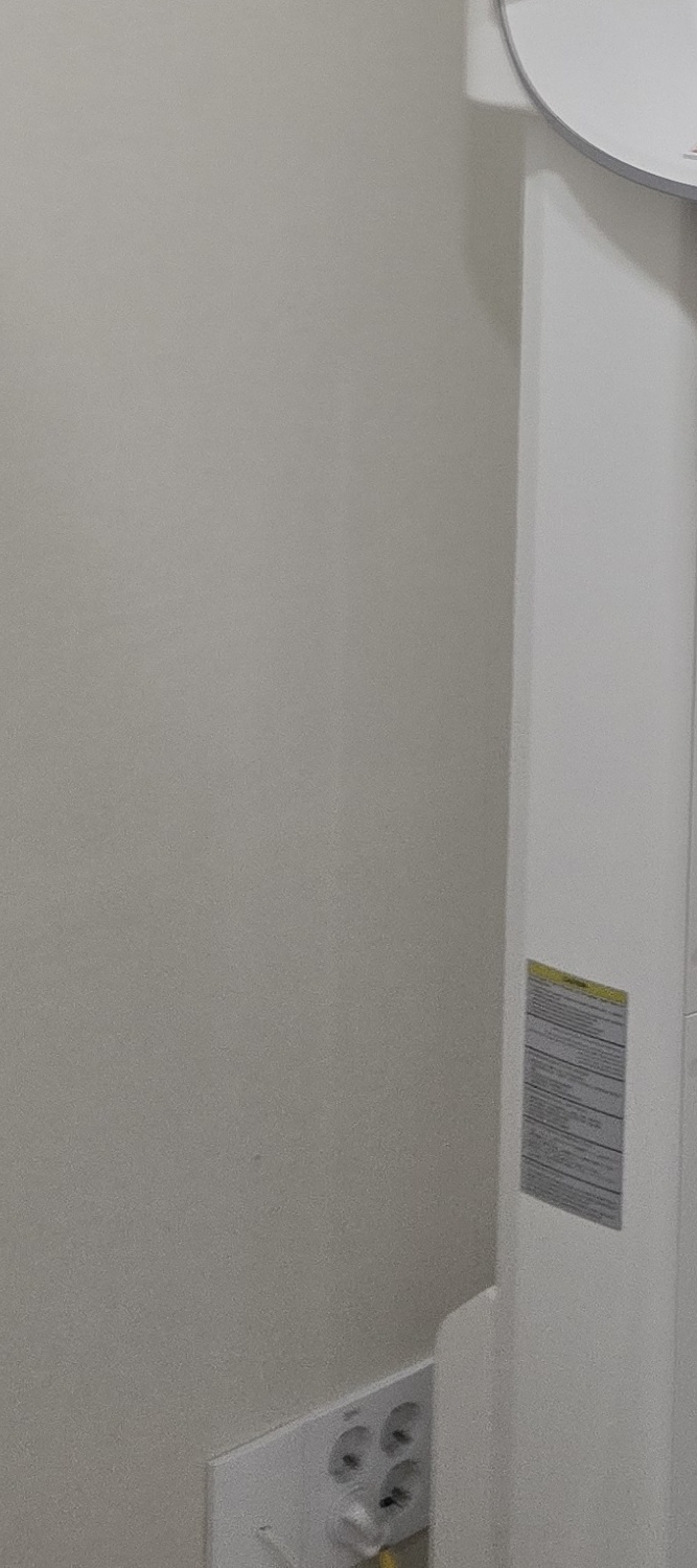 앞니 틀어짐 교정 이렇게 파악하세요 관련 이미지 30