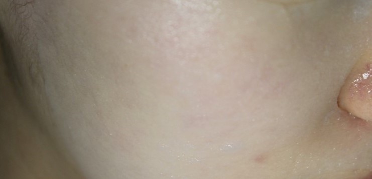 스파클링마스크 모공을 촘촘하게 관리해주는 인클로즈 시크릿 데일리케어 마스크 관련 이미지 14