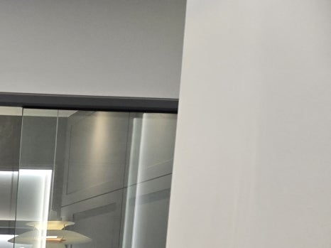 65세이상 임플란트 개수 구체적으로 체크하려면 관련 이미지 12