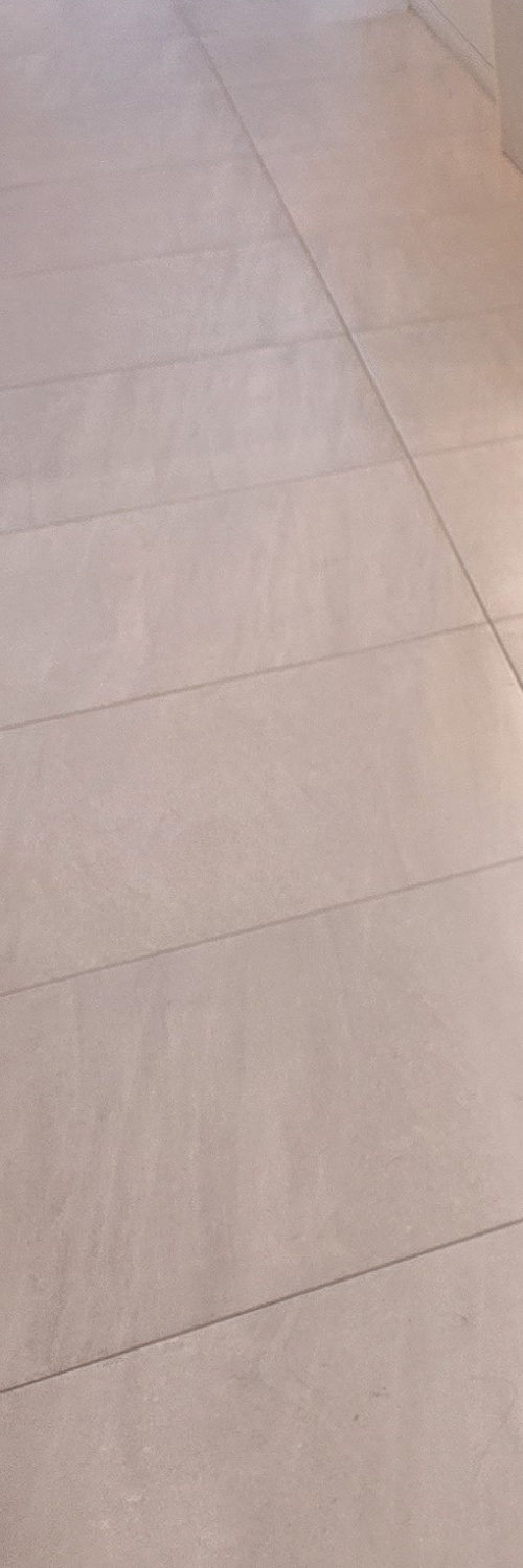 부분매복 사랑니 발치 신중하게 대비하려면 관련 이미지 15